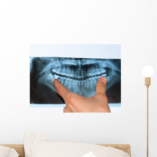 Dental X-Ray panoramic Wall Mural