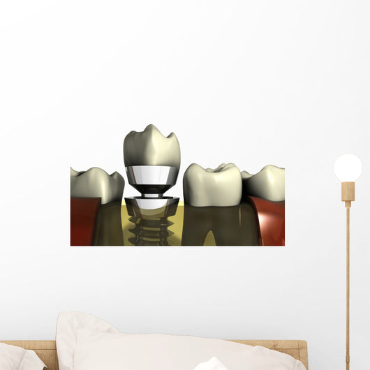 Dental Aesthetics