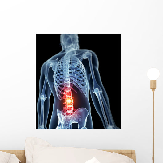 3D Rendered Illustration Backache
