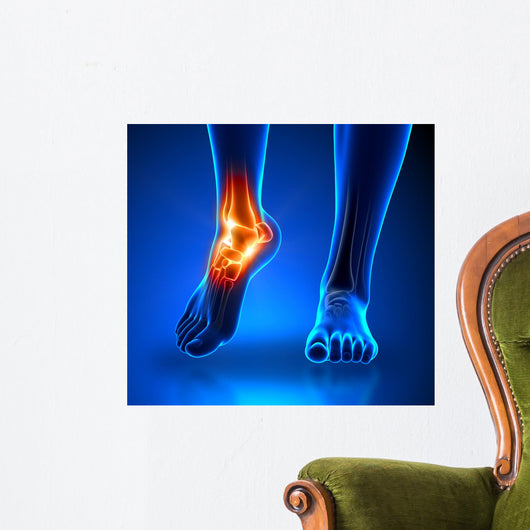 Ankle Pain Detail