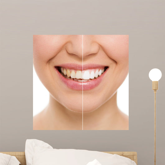 Before and after Bleaching Wall Decal