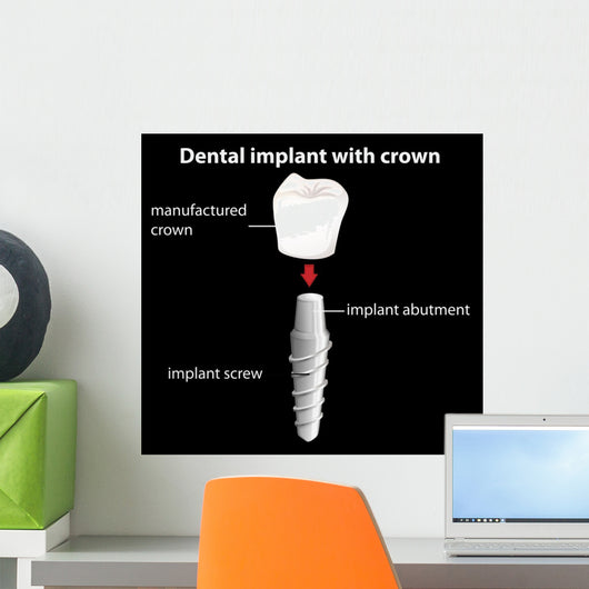 A Dental Implant With Crown