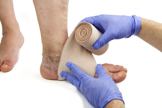 Varicose veins and bandage Wall Decal