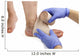 Varicose veins and bandage Wall Decal