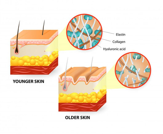 Skin Aging Diagram Wall Decal