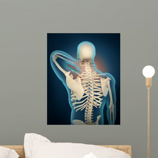 Medical Illustration Showing Inflammation Wall Decal Design 3