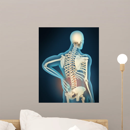 Medical Illustration Showing Inflammation Wall Decal Design 2