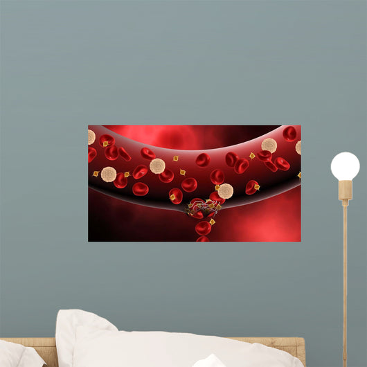 Blood Clotting inside Artery Wall Decal