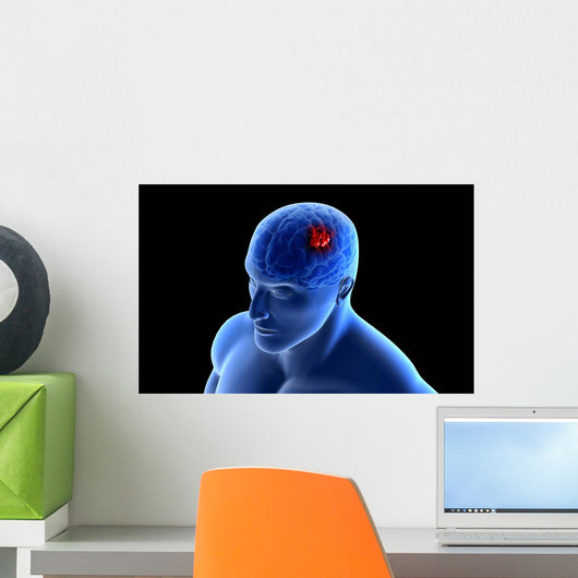 Conceptual Image Tumor Human Wall Decal