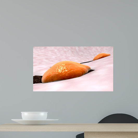 Osteoclast Breaking down Bone Wall Decal Design 1