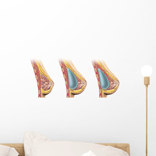 Woman Breast Implant Cross Wall Decal