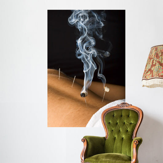 Patient Receiving Acupuncture Treatment Wall Decal