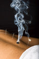 Patient Receiving Acupuncture Treatment Wall Decal