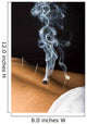 Patient Receiving Acupuncture Treatment Wall Decal