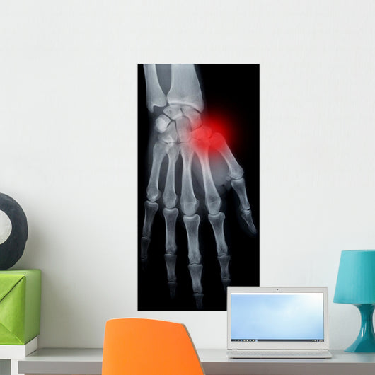 Pain hand Wall Mural