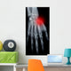Pain hand Wall Mural