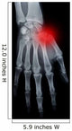 Pain hand Wall Mural