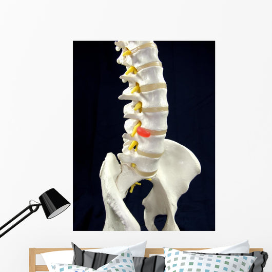 Spinal Disc Anatomy Wall Mural