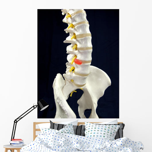 Spinal Disc Anatomy Wall Mural