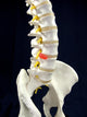 Spinal Disc Anatomy Wall Mural