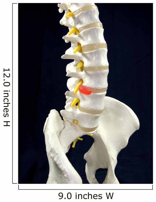 Spinal Disc Anatomy Wall Mural