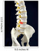 Spinal Disc Anatomy Wall Mural