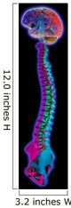 Brain and Spine on Black Wall Mural
