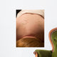 acupuncture Wall Mural