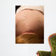 acupuncture Wall Mural