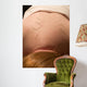 acupuncture Wall Mural