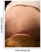 acupuncture Wall Mural