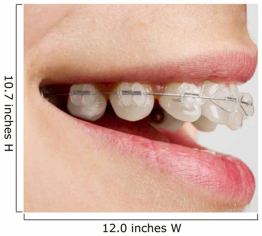Braces on teeth Wall Mural