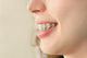 Girl smiles with braces Wall Mural