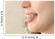 Girl smiles with braces Wall Mural