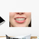 Girl Smiles with Braces Wall Decal
