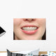Girl Smiles with Braces Wall Decal