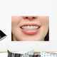 Girl Smiles with Braces Wall Decal
