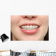 Girl Smiles with Braces Wall Decal