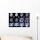 X-ray Picture Brain Wall Decal