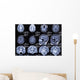 X-ray Picture Brain Wall Decal