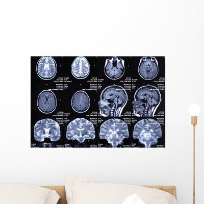 X-ray Picture Brain Wall Decal shown on a wall