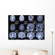 X-ray Picture Brain Wall Decal