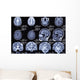 X-ray Picture Brain Wall Decal
