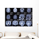 X-ray Picture Brain Wall Decal