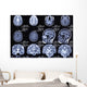 X-ray Picture Brain Wall Decal