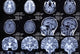 X-ray Picture Brain Wall Decal