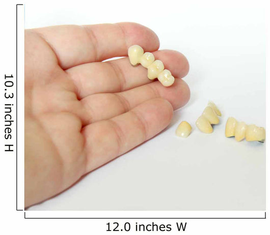 Porcelain Crowns Bridge Dentistry Wall Decal