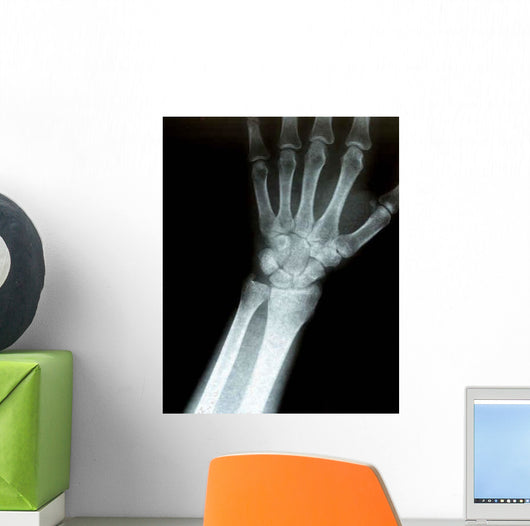 Xray Wrist Wall Decal