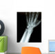 Xray Wrist Wall Decal