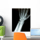 Xray Wrist Wall Decal